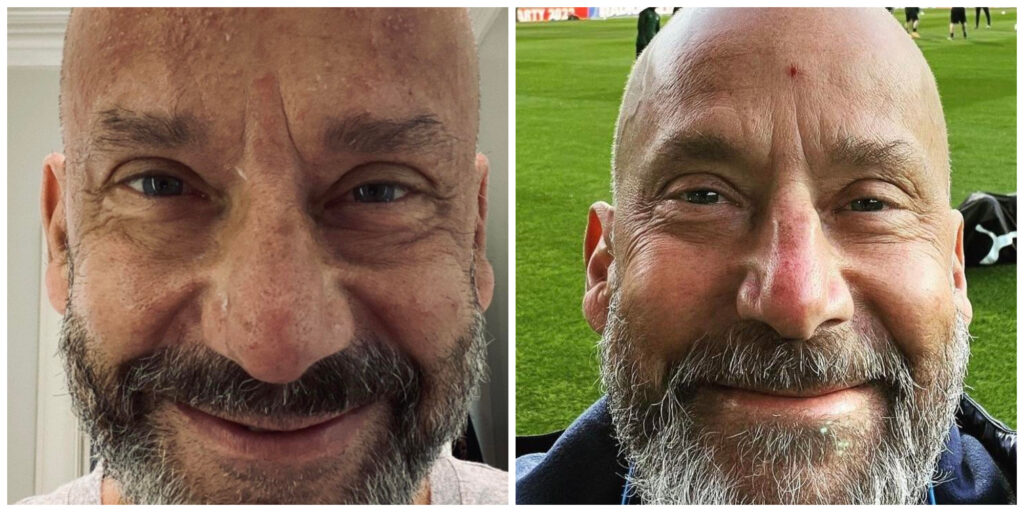 Gianluca Vialli ricoverato a Londra in gravi condizioni